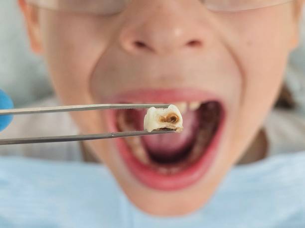 Best Cosmetic Emergency Dentistry in Farmers Branch, TX